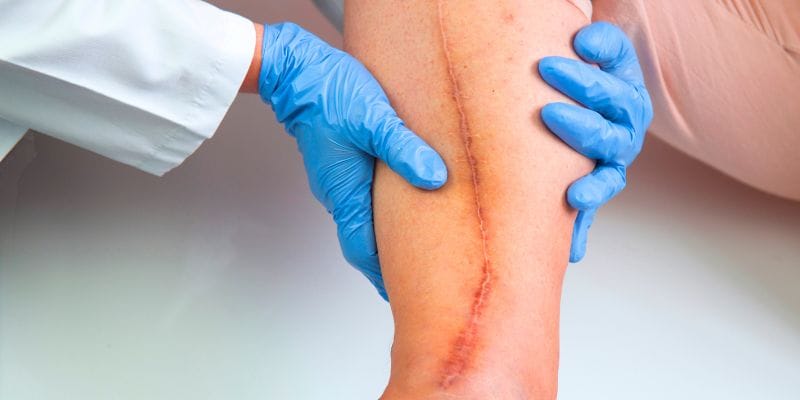 Dor Pós-Operatória